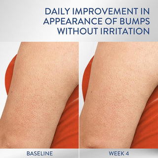 CETAPHIL Daily Smoothing Moisturizer for Rough & Bumpy Skin 296ml