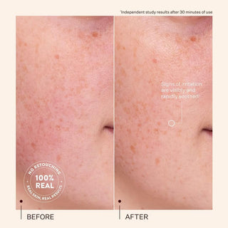 PEACH AND LILY Rescue Party Barrier Restore Serum