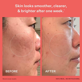 PEACH & LILY Glass Skin Refining Serum