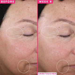 FARMACY 1% Vitamin A Retinol Serum 30ml