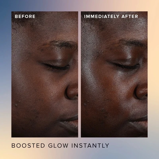 FARMACY Honey Glow 17% AHA + BHA Resurfacing Acid Serum 30ml