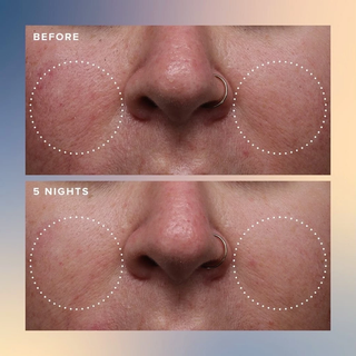 FARMACY Honey Glow 17% AHA + BHA Resurfacing Acid Serum 30ml