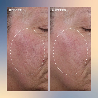 FARMACY Honey Glow 17% AHA + BHA Resurfacing Acid Serum 30ml