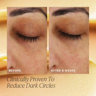 FARMACY Wake Up Honey Eye Cream 15ml