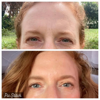 FROWNIES Reusable Collagen Under Eye Gels 3pcs