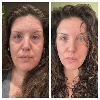 FROWNIES Forehead and Between Eyes Patches 144pcs