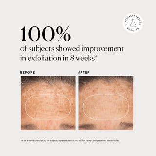 NATURIUM BHA Liquid Exfoliant 2% 120ml