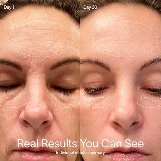 SOLAWAVE Advanced Skincare Wand with Red Light Therapy