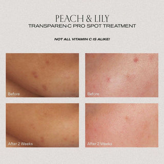 PEACH & LILY Transparen-C Pro Spot Treatment