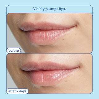 SKINFIX Barrier+ Triple Lipid Lip Treatment