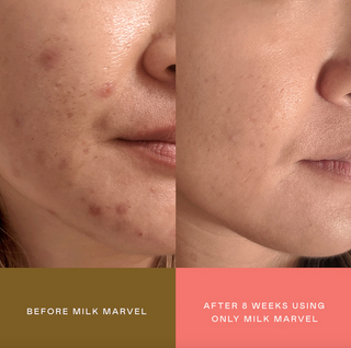 EADEM Milk Marvel Dark Spot Serum 30ml