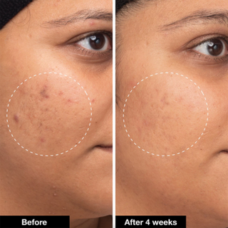 EADEM Milk Marvel Dark Spot Serum 30ml