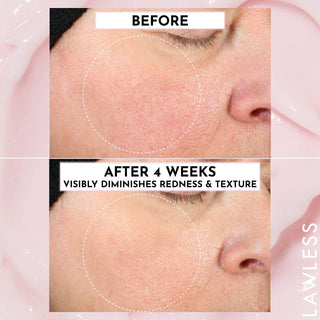 LAWLESS Forget the Filler Skin-Plumping Line-Smoothing Perfecting Cream