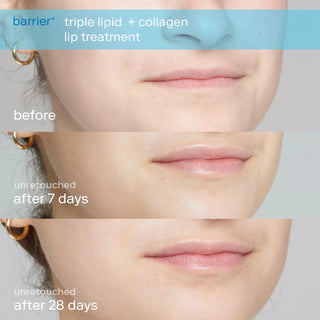 SKINFIX Barrier+ Triple Lipid Lip Treatment