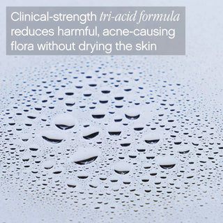 TOPICALS Clearly Acne Mist 100ml