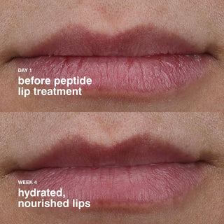 RHODE Peptide Lip Treatment
