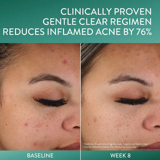 CETAPHIL Gentle Clear Triple-Action Acne Serum 30ml