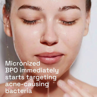 CETAPHIL Gentle Clear Complexion Clearing Acne Cleanser 124ml